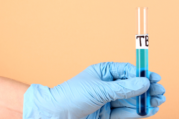 TB 500 Dosage in Research TB-500 Dosage in Research | Study Protocol Insights TB-500 Dosage in Research